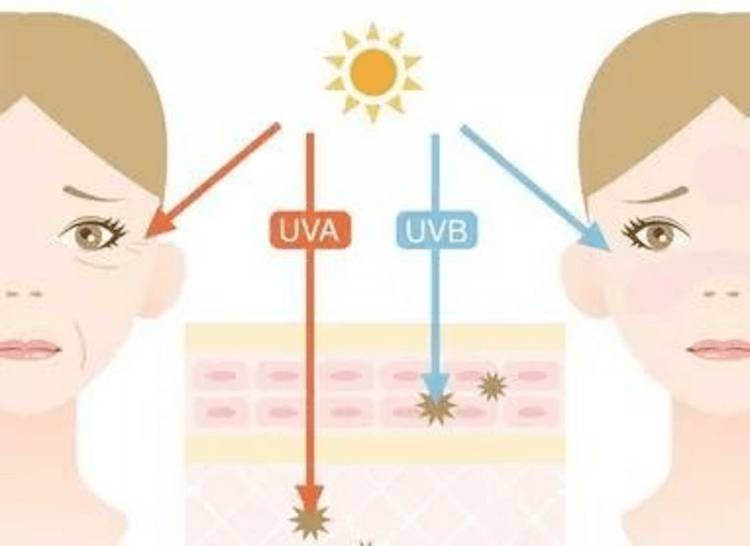 【UVLED固化小百科】UVLED紫外線的預防和緩解方法
